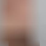 Bragas y coordinamos