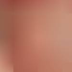 Body lencero